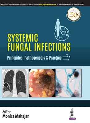 Systemic Fungal Infections by Mahajan, Monica