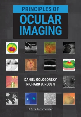 Principles of Ocular Imaging by Gologorsky, Daniel