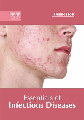 Essentials of Infectious Diseases by Frost, Jasmine