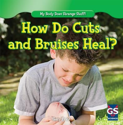 How Do Cuts and Bruises Heal? by Frick, Gary