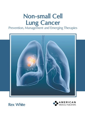 Non-Small Cell Lung Cancer: Prevention, Management and Emerging Therapies by White, Rex