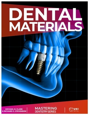 Mastering Dentistry Series: Dental Material: Handbook of Dental Materials by Stevenson, Richard G.