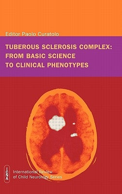 Tuberous sclerosis complex: from basic science to clinical phenotypes by Curatolo, Paolo