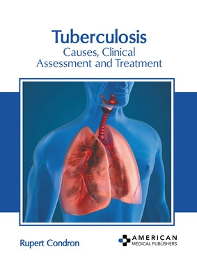 Tuberculosis: Causes, Clinical Assessment and Treatment by Condron, Rupert