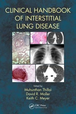 Clinical Handbook of Interstitial Lung Disease by Meyer, Keith C.