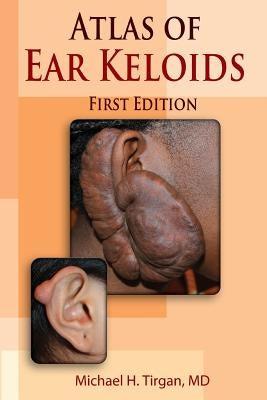 Atlas of Ear Keloids by Tirgan, Michael H.