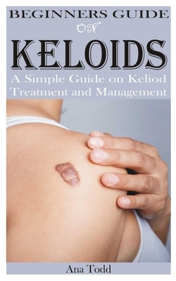 Beginners Guide on Keloids by Todd, Ana