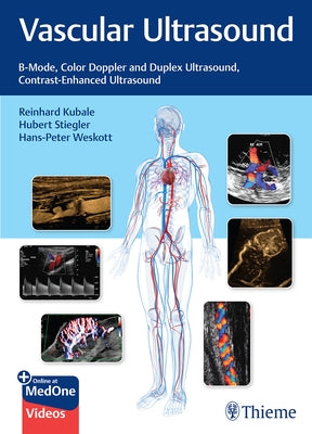 Vascular Ultrasound: B-Mode, Color Doppler and Duplex Ultrasound, Contrast-Enhanced Ultrasound by Kubale, Reinhard