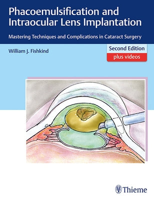 Phacoemulsification and Intraocular Lens Implantation: Mastering Techniques and Complications in Cataract Surgery by Fishkind, William J.