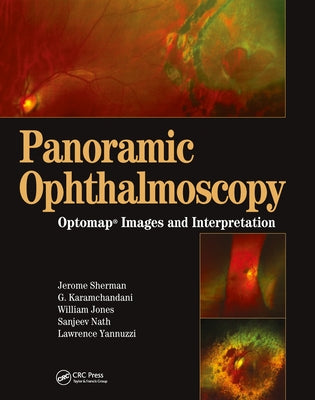 Panoramic Ophthalmoscopy: Optomap Images and Interpretation by Sherman, Jerry