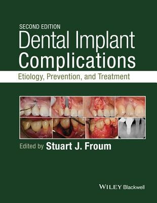 Dental Implant Complications: Etiology, Prevention, and Treatment by Froum, Stuart J.