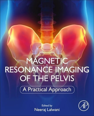 Magnetic Resonance Imaging of the Pelvis: A Practical Approach by Lalwani, Neeraj