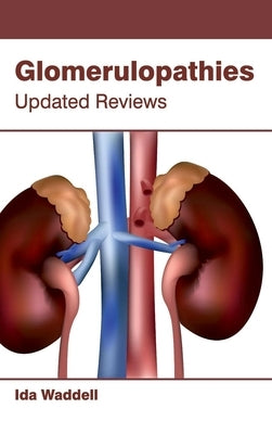 Glomerulopathies: Updated Reviews by Waddell, Ida