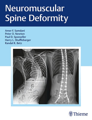 Neuromuscular Spine Deformity by Samdani, Amer F.