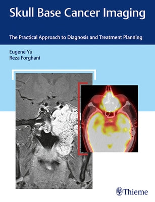 Skull Base Cancer Imaging: The Practical Approach to Diagnosis and Treatment Planning by Yu, Eugene