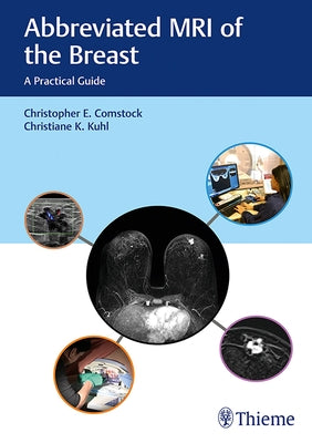 Abbreviated MRI of the Breast: A Practical Guide by Comstock, Christopher E.