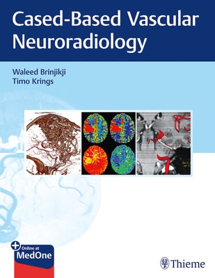 Imaging in Neurovascular Disease: A Case-Based Approach by Brinjikji, Waleed