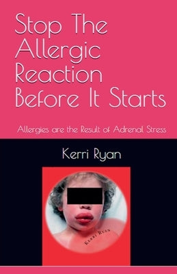 Stop the Allergic Reaction Before It Starts by Ryan, Kerri