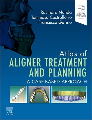 Atlas of Aligner Treatment and Planning: A Case-Based Approach by Nanda, Ravindra