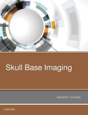Skull Base Imaging by Chong, Vincent