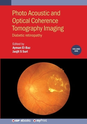 Photo Acoustic and Optical Coherence Tomography Imaging, Volume 1: Diabetic retinopathy by El-Baz, Ayman