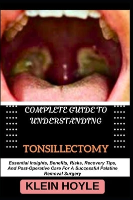 Complete Guide to Understanding Tonsillectomy: Essential Insights, Benefits, Risks, Recovery Tips, And Post-Operative Care For A Successful Palatine R by Hoyle, Klein