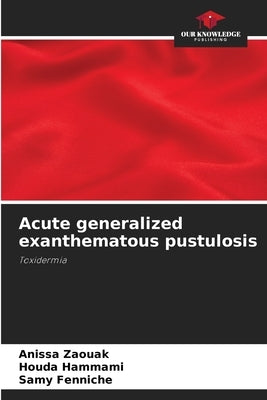 Acute generalized exanthematous pustulosis by Zaouak, Anissa