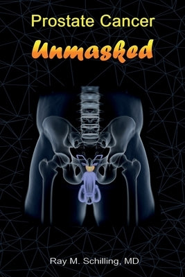 Prostate Cancer Unmasked by Schilling, Ray M.