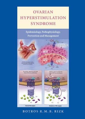 Ovarian Hyperstimulation Syndrome: Epidemiology, Pathophysiology, Prevention and Management by Rizk, Botros R. M. B.