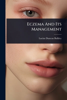 Eczema And Its Management by Bulkley, Lucius Duncan