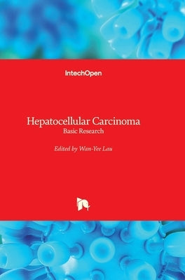 Hepatocellular Carcinoma: Basic Research by Lau, Joseph W. Y.