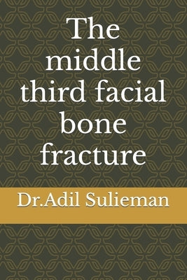 The middle third facial bone fracture by Sulieman, Adil