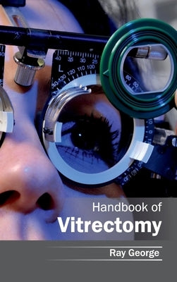 Handbook of Vitrectomy by George, Ray
