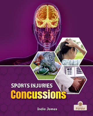 Concussions by James, India