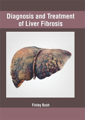 Diagnosis and Treatment of Liver Fibrosis by Bush, Finley