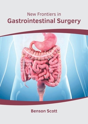 New Frontiers in Gastrointestinal Surgery by Scott, Benson