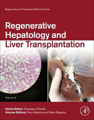 Regenerative Hepatology and Liver Transplantation: Volume 2 by Martins, Paulo