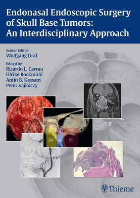 Endonasal Endoscopic Surgery of Skull Base Tumors: An Interdisciplinary Approach by Draf, Wolfgang