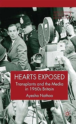 Hearts Exposed: Transplants and the Media in 1960s Britain by Nathoo, A.