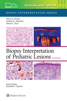 Biopsy Interpretation of Pediatric Lesions: Print + eBook with Multimedia by Husain, Aliya Noor