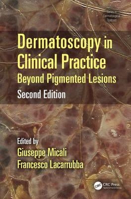 Dermatoscopy in Clinical Practice: Beyond Pigmented Lesions by Micali, Giuseppe