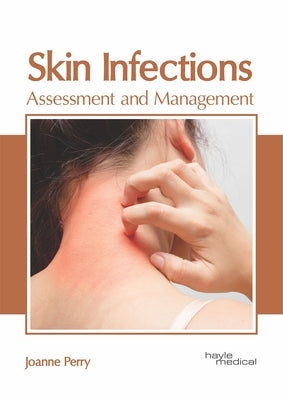 Skin Infections: Assessment and Management by Perry, Joanne