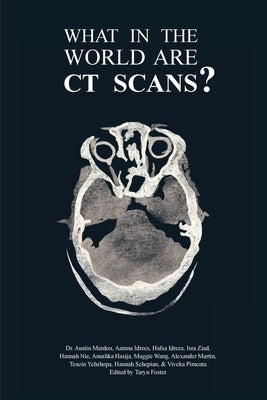What in the World are CT Scans? by Mardon, Austin