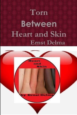 Torn between Heart and Skin by Delma, Ernst