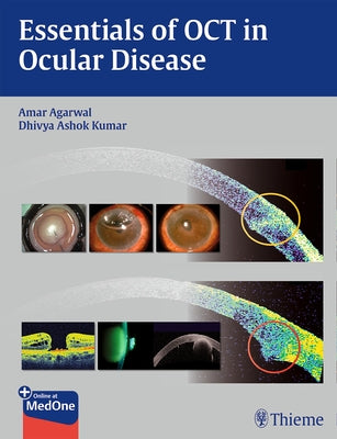 Essentials of Oct in Ocular Disease by Agarwal, Amar
