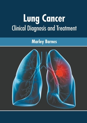 Lung Cancer: Clinical Diagnosis and Treatment by Barnes, Marley