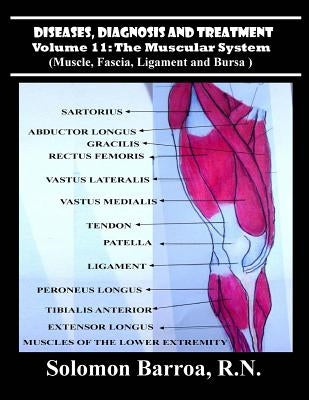 Diseases, Diagnosis and Treatment by Barroa, Solomon