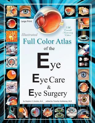 Illustrated Full Color Atlas of the Eye, Eye Care, and Eye Surgery - LARGE PRINT Edition by Holekamp, Timothy