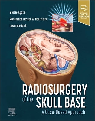 Radiosurgery of the Skull Base: A Case-Based Approach by Agazzi, Siviero
