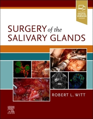 Surgery of the Salivary Glands by Witt, Robert L.